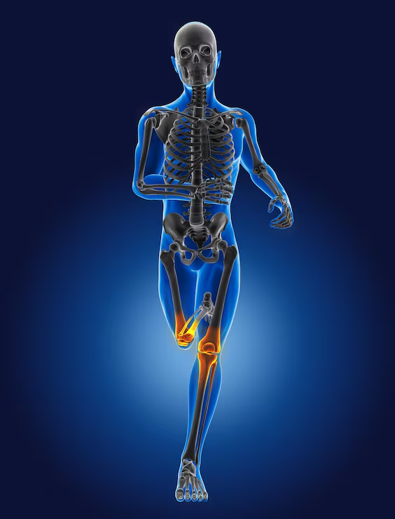 running injuries (1)