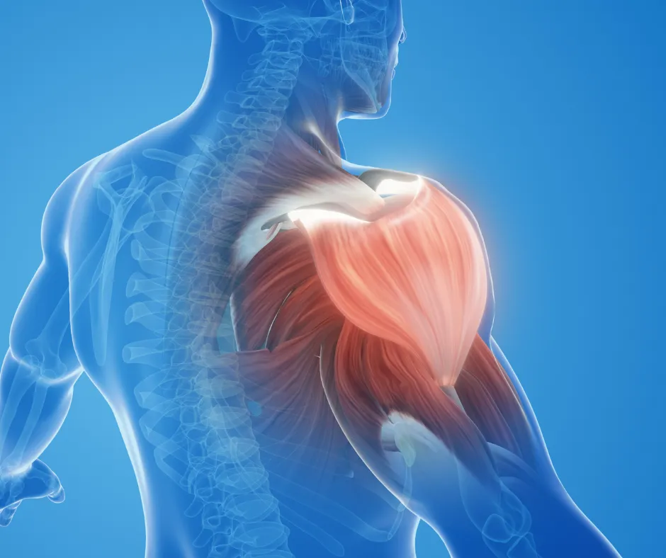 shoulder pain
